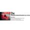 Dunggabel Zinken-L.320mm 4 Zinken Fiberglas T-Stiel 3001 G.1630g POLET